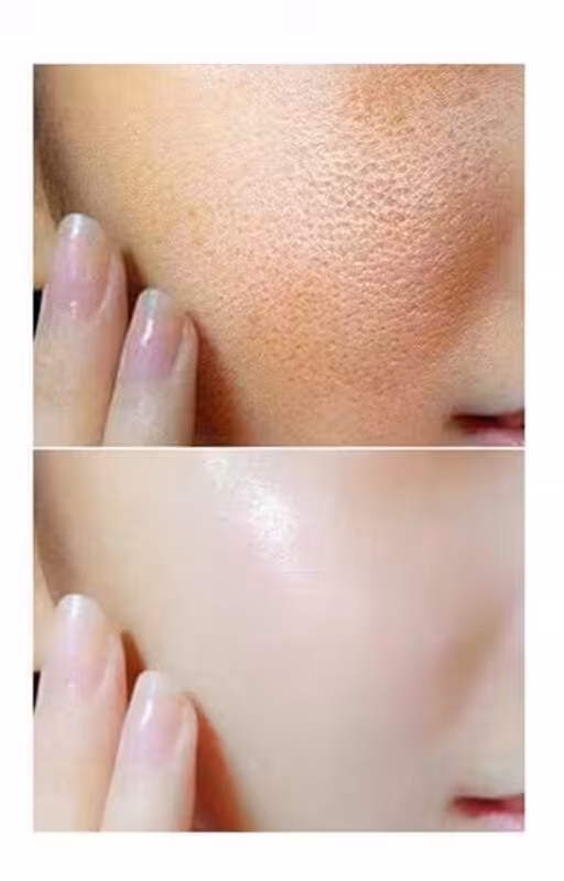 niacinamide-benefici